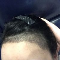 發(fā)際線用戶圖片