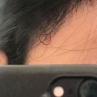 發(fā)際線用戶圖片