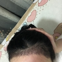 發(fā)際線用戶圖片