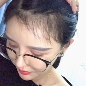 发际线分享社区