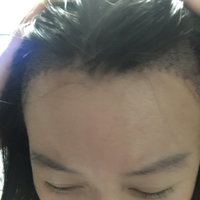 發(fā)際線用戶圖片