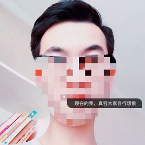 发际线分享社区