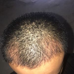 发际线分享社区
