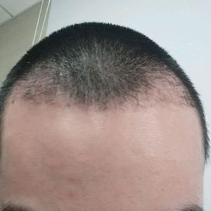 发际线分享社区