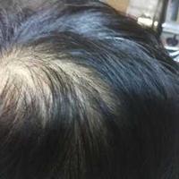 禿頂用戶圖片