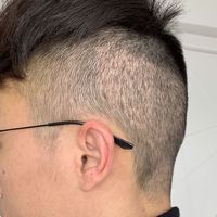 發(fā)際線用戶圖片