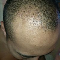 發(fā)際線用戶圖片
