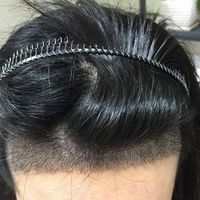 發(fā)際線用戶圖片