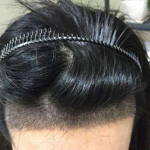 发际线分享社区