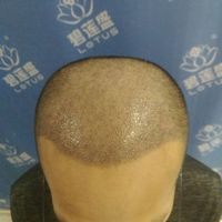 發(fā)際線用戶圖片