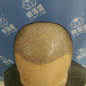 发际线分享社区