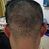 發(fā)際線用戶圖片