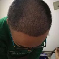 發(fā)際線用戶圖片