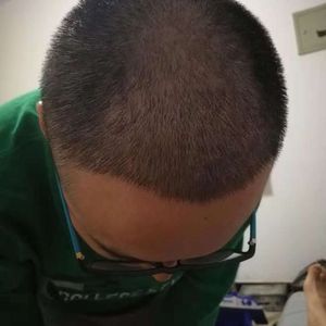 发际线分享社区