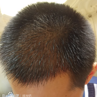 發(fā)際線用戶圖片