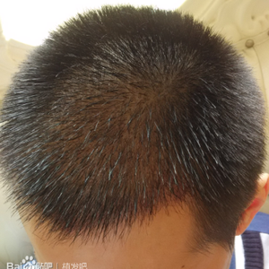 发际线分享社区