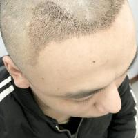 發(fā)際線用戶圖片