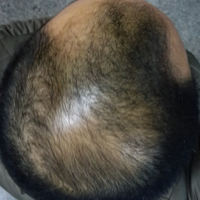 <font color="red">稀少加密</font>用戶圖片