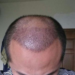 发际线分享社区