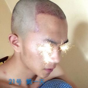 发际线分享社区