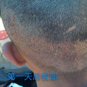 发际线分享社区