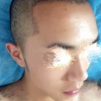 發(fā)際線用戶圖片