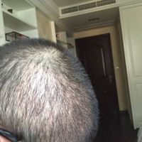 發(fā)際線用戶圖片
