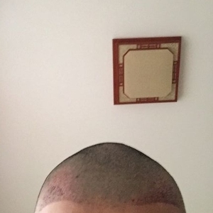 发际线分享社区