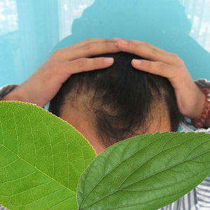 发际线分享社区