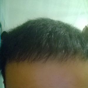 发际线分享社区