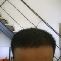 發(fā)際線用戶圖片