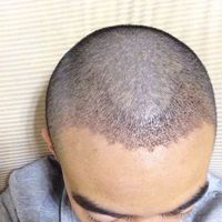 發(fā)際線用戶圖片