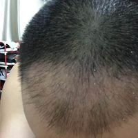 發(fā)際線用戶圖片