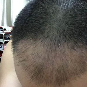 发际线分享社区