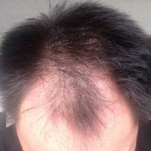 发际线分享社区