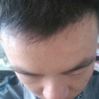 發(fā)際線用戶圖片