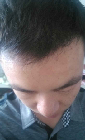 发际线分享社区