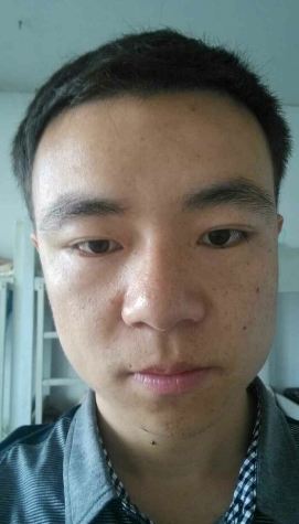 发际线分享社区