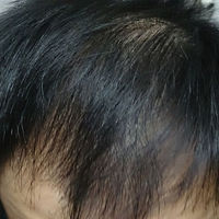 <font color="red">稀少加密</font>用戶圖片