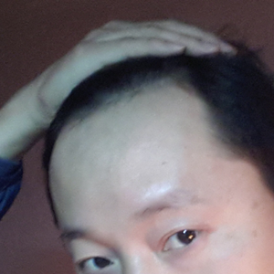 发际线分享社区