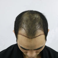 發(fā)際線用戶圖片