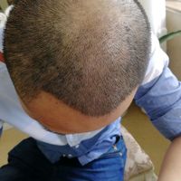 發(fā)際線用戶圖片