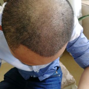 发际线分享社区