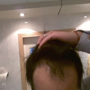 发际线分享社区