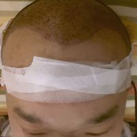 發(fā)際線用戶圖片