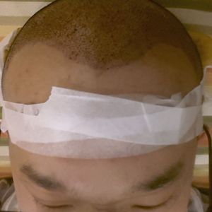 发际线分享社区