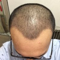 發(fā)際線用戶圖片