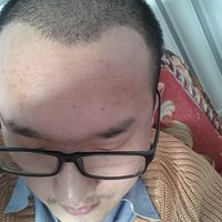 發(fā)際線用戶圖片