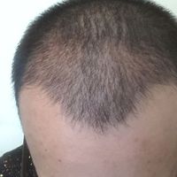發(fā)際線用戶圖片