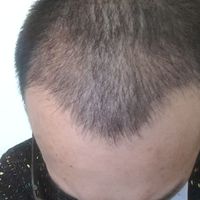 發(fā)際線用戶圖片